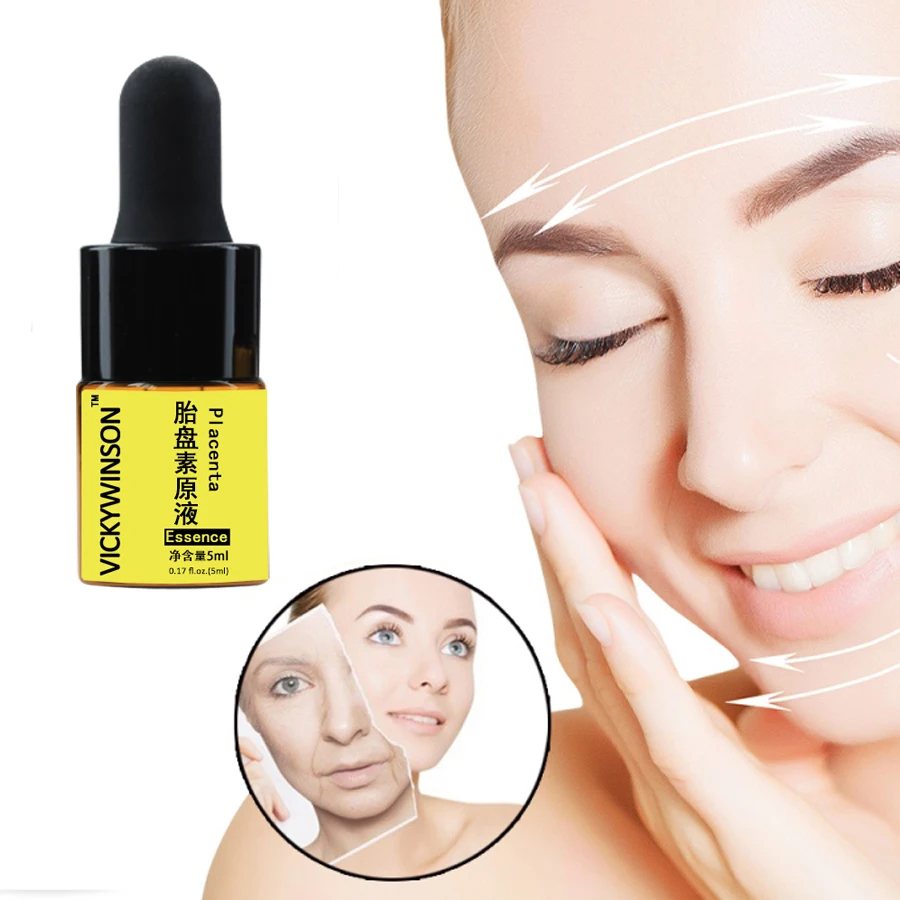 Placenta Essentie 5Ml Hydraterende En Anti-Aging Van De Essentie Van Schapen Placenta Ruwe