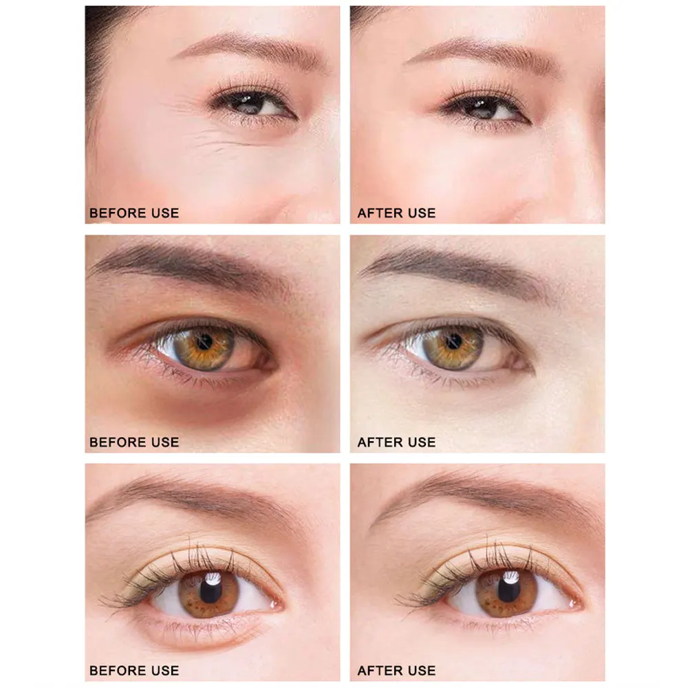 ARTISCARE قناع عين اللؤلؤ الأسود الكولاجين كريستال العين بقع 60 قطعة أكياس العين الهالات السوداء التجاعيد ترطيب العناية بالعين