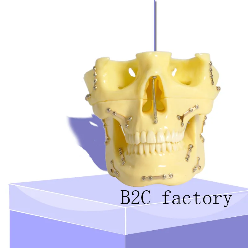 

Dental model 2016 Anchor Implant Screw Practice Model