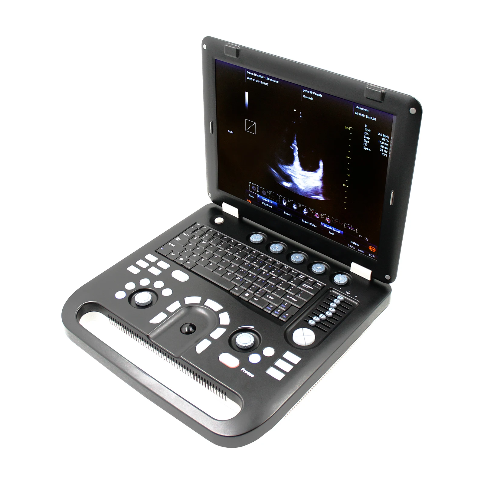 Portable Color Doppler CONTEC CMS1700A CMS1700B CMS1700C Ultrasound Scanner Machine+ convex Probe 2021 newest