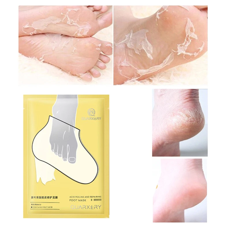 Mascarilla Exfoliante para pies, calcetines exfoliantes para pedicura, en el talón antigrietas, parche para eliminar la piel del pie