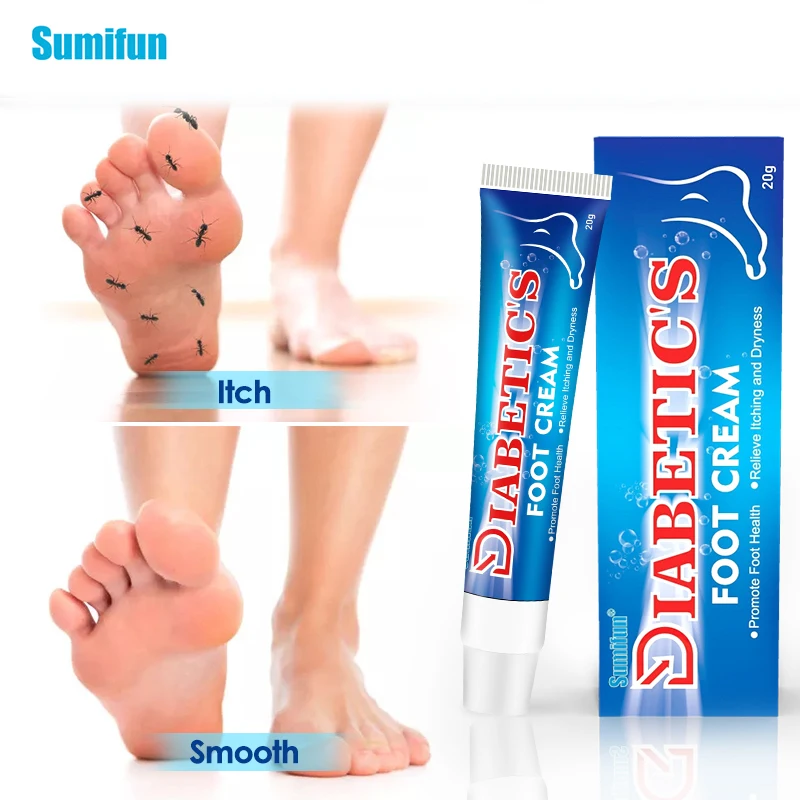 

20g Sumifun Diabetes Foot Treatment Cream Anti Inflammation Diabetic Foot Ulceration Cream Itch Relief Moisturizing Skin Care