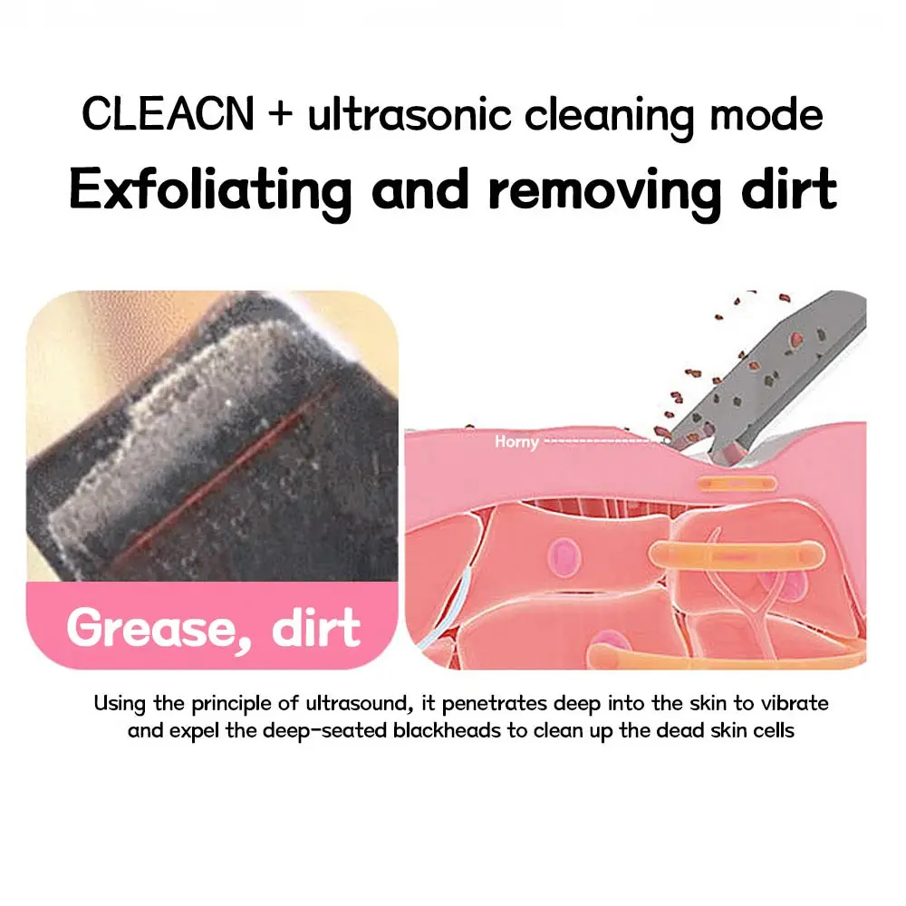 Ultrasuoni Scrubber detergente per il viso ione Acne rimozione di punti neri Peeling pala detergente massaggiatore facciale macchina per il lifting del viso