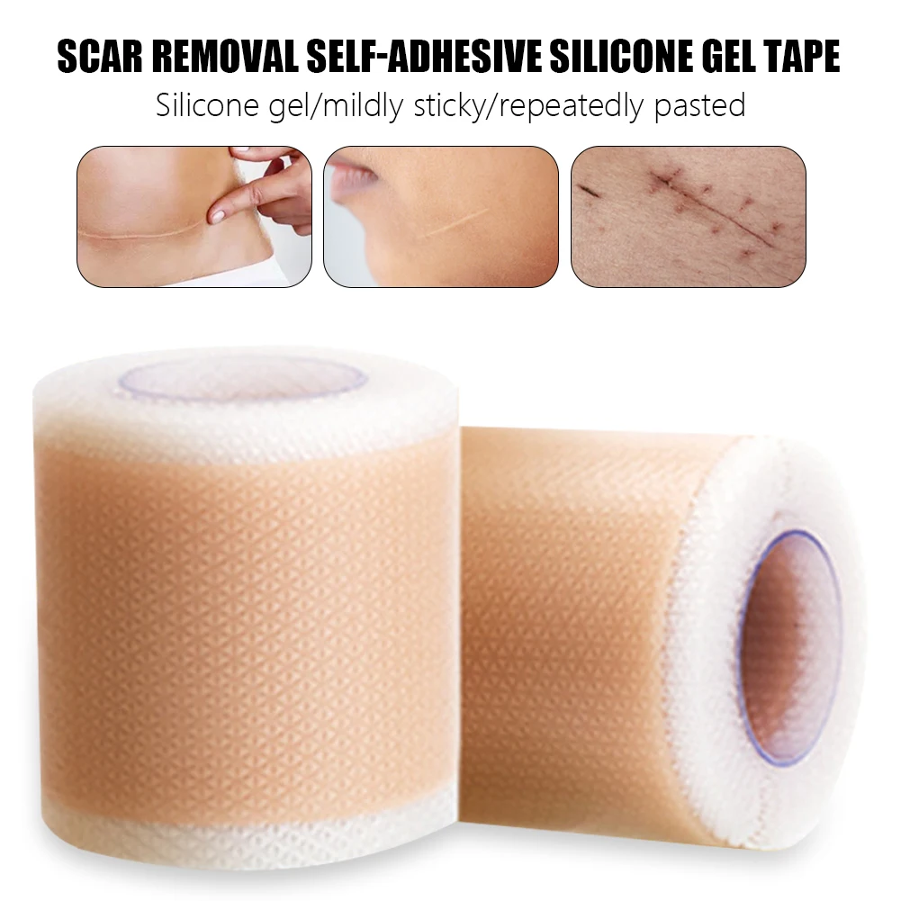 4x50cm Silicone Gel Scar Sheet Patch Treatment Removal Tape Acne Trauma Burn Scar Cover Skin Repair Section Ear Beauty