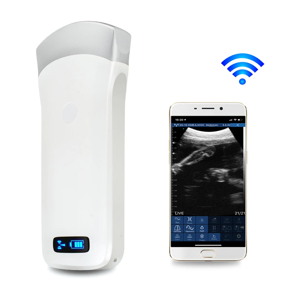 

Portable Ultrasound USG Scanner Convex Array Probe 3.5Mhz 80 Elements 16 Channel WIFI Wireless Scanner Machine USB for Pregnant