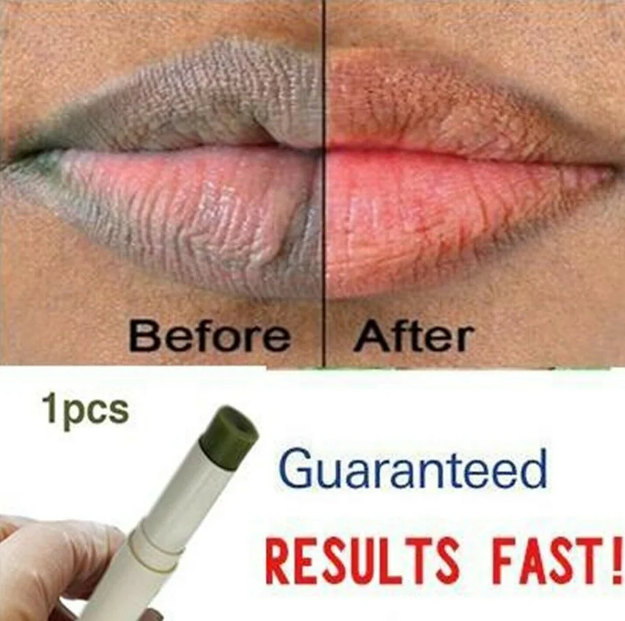 Labios Rosa fresco aclaramiento rápido crema blanqueadora bálsamo tratamiento eliminar labios oscuros