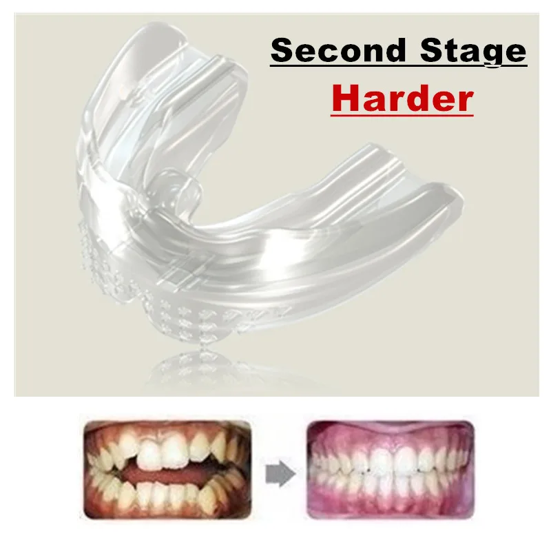 

Second Stage Harder Dental Dentis Lab Oral Orthodontic Brace Straight Teeth System for Children & Adult Tooth Correction