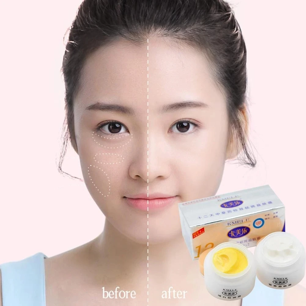 Original 20 Sets Kemele Kmele Whitening Cream Effect In 12 Days Morning And Night Cream Combo