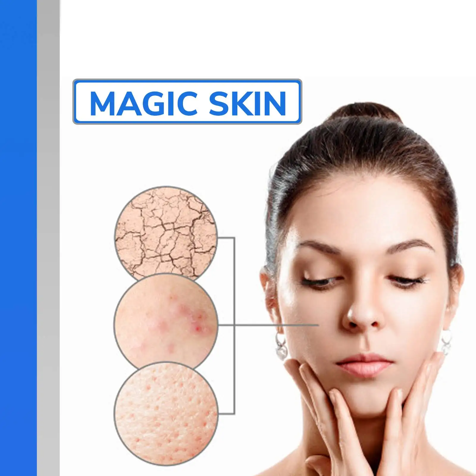 Ácido glicólico Pele Facial Peel, 70% Químico, Pigmentação Acne, Gatos WRINKLES, Pres ANTI-ENVELHECIMENTO