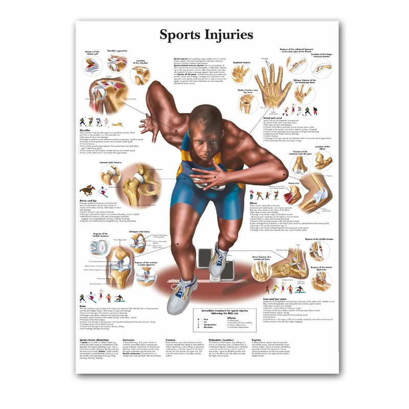 WANGART Sports Injuries Chat Anatomy Pathology Self Examinatio Canvas Print Wall Pictures Medical Education Office Home Decor