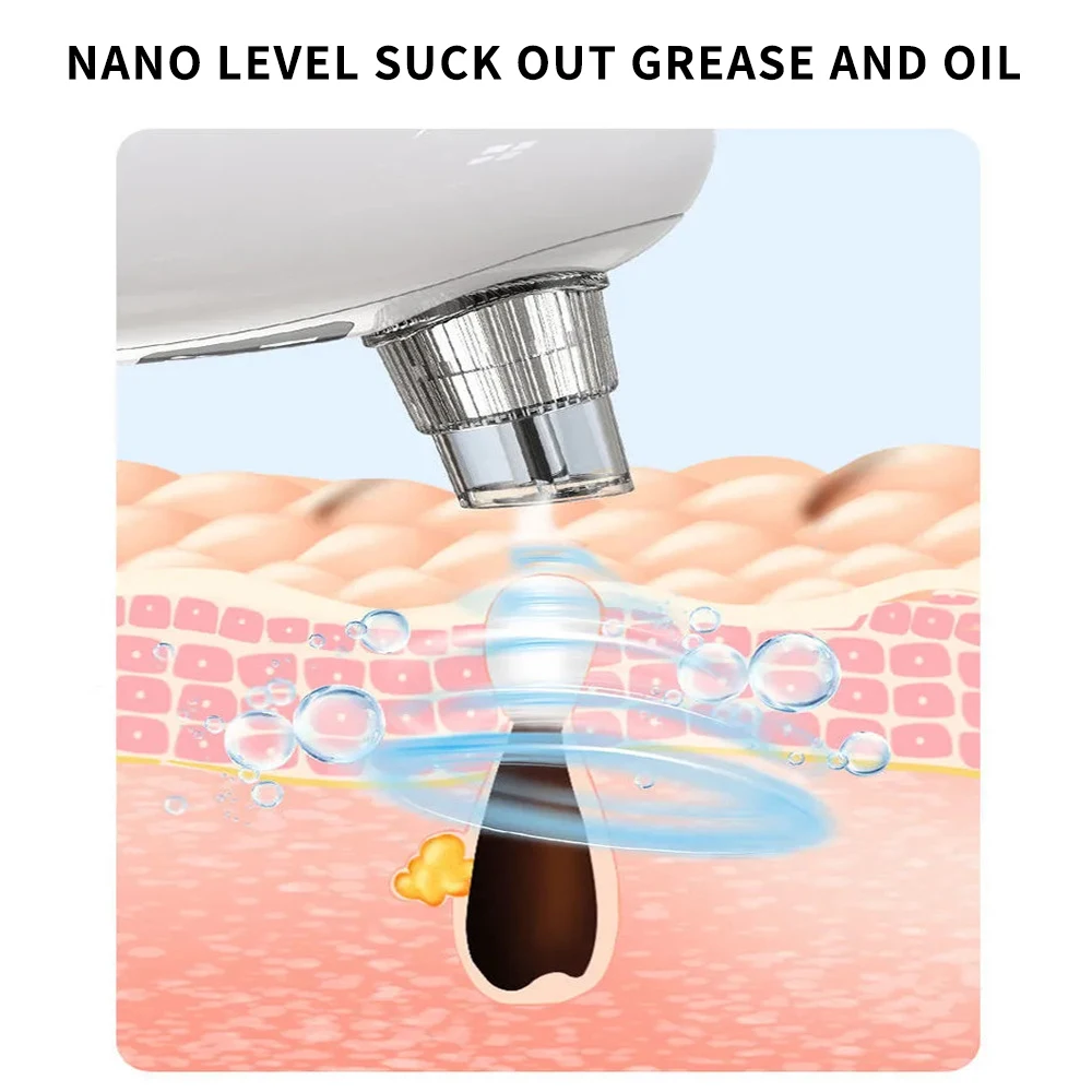 にきびやにきび用の小型電動バブル掃除機,真空吸引,顔面毛穴クリーナー