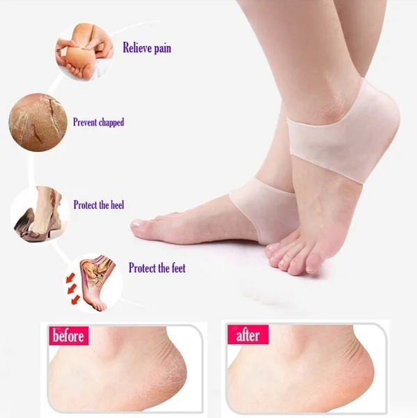 1 Pc Silicone Plantar Fasciitis Shock Absorbing Gel Sleeve Breathable Protective Heel Cracked Foot Skin Care Pain Relief