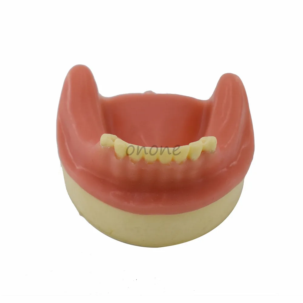 1pcs Teeth Model with Gingiva Bone Imitating Oral Teaching Aids Dental Implant Placement Exercise Practice model