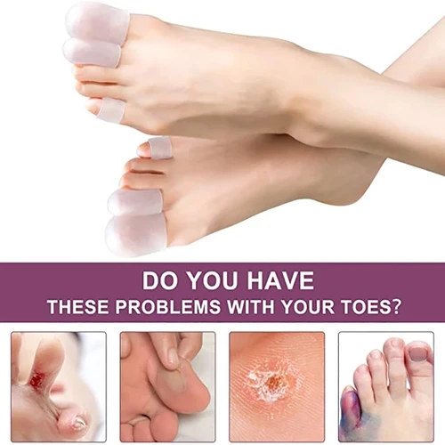 Imagen 2 del producto 6 uds Gel de silicona dedo del pie tubo removedor de ampolla de maíz corrección de juanete Protector de dedos manga alivio del dolor cuidado de los pies separador de dedos