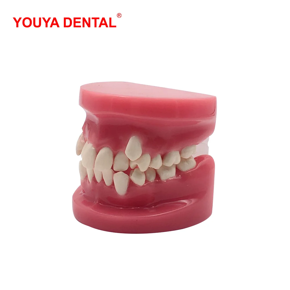 3D Resin Dental Model Teeth Malocclusion Model For Demostration Teaching Dentist Students Study Oral Medical  Dentistry Products