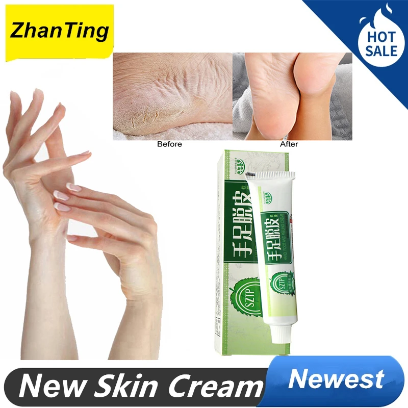 3 Pcs Hand Foot Peeling Horse Oil Feet Cream Athlete Hand Foot Feet Itch Blisters Anti Chapping Peeling Foot Care Cream