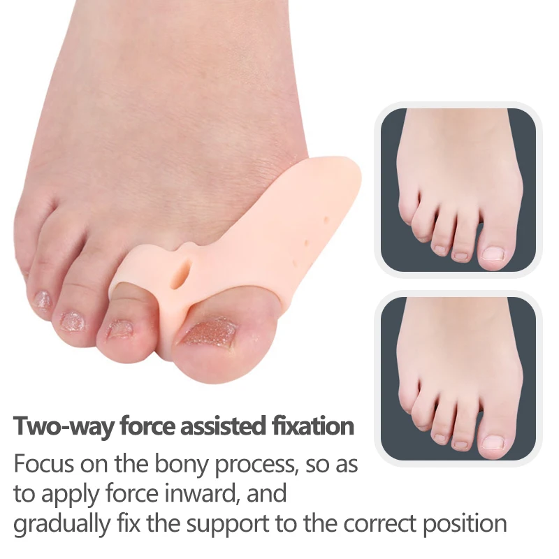 Mathiateur de pieds en silicone, 2 pièces, lisseur pour orteils, coussin de callosités, hallux valgus