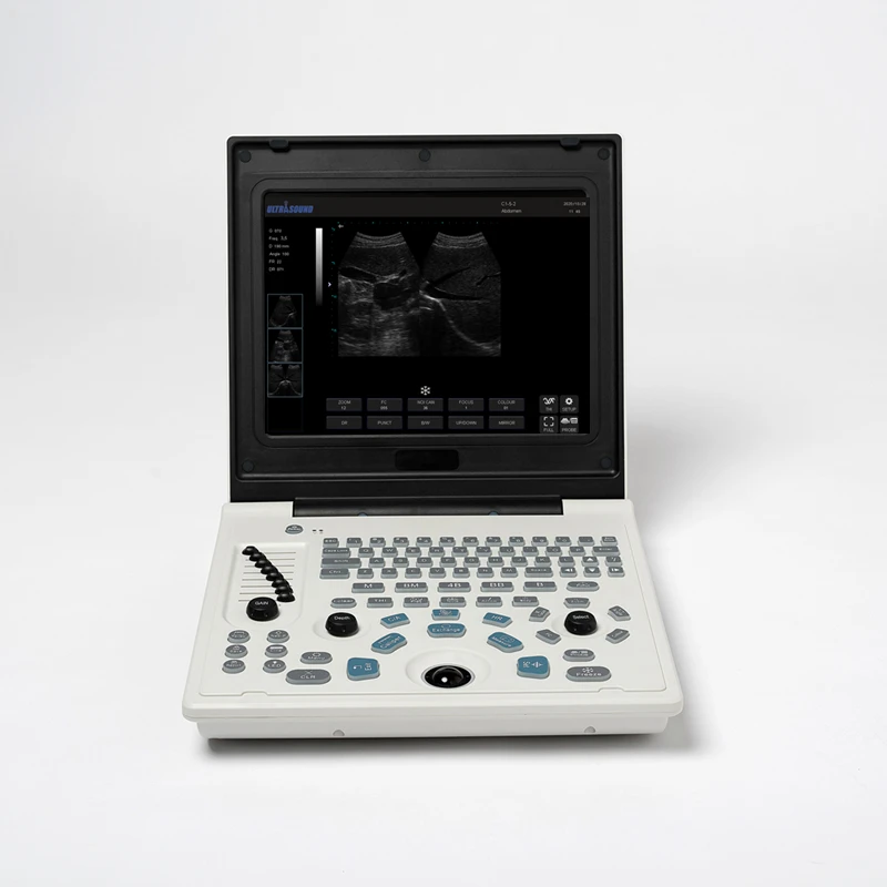 12 Inch LED Screen Notebook Ultrasound USG Scanner