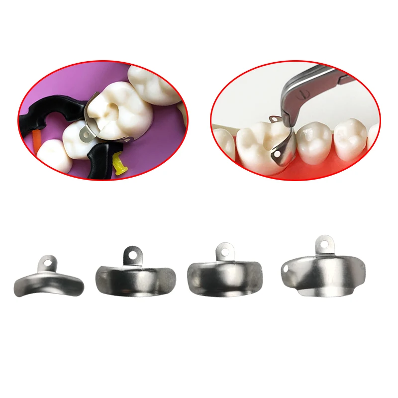 Bandas de matriz Dental seccionales contorneadas, matriz de Metal para reemplazo de dientes, herramientas de dentista, Material de odontología,