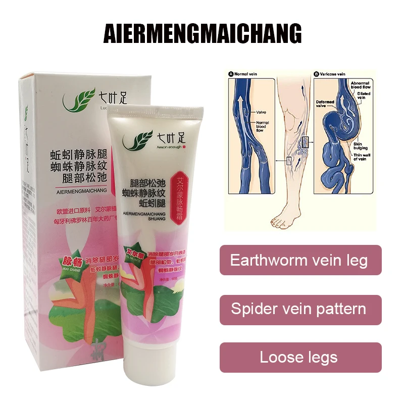 

60G Varicose Veins Cream Effective Treatment Vasculitis Phlebitis Spider Leg Natural Herb Angiitis Veins Swelling Pain Ointment
