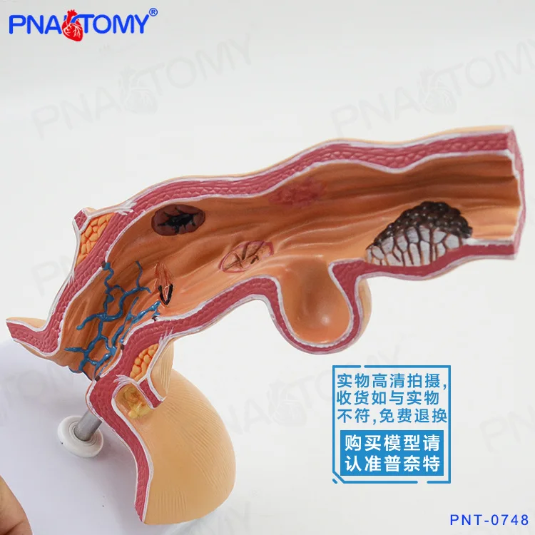 1:1 Life-sized Human  Pathological Esophagus Anatomical Model Digestive System Stomach Respiratory Organs Digestive Structure