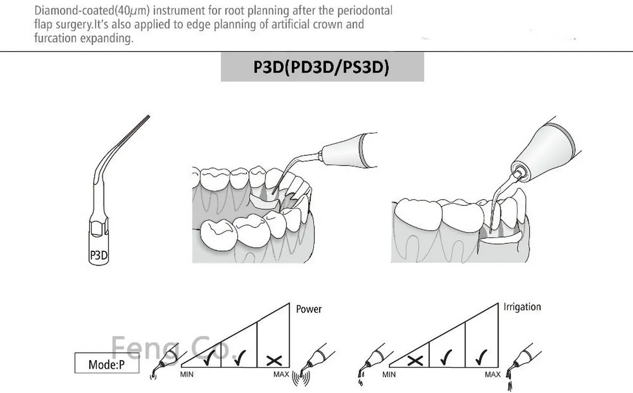 PD3D Dental Ultrasonic Scaler Tips Scaling  Endo Perio Fit SATELEC NSK DTE GNATUS HU-FREIDY Handpiece Dentist Teeth Whitening