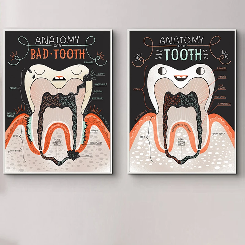 Anatomy Of Good And Bad Teeth Wall Art Posters Painting Dental Science Knowledge Canvas Painting Office Poster Decor Picture