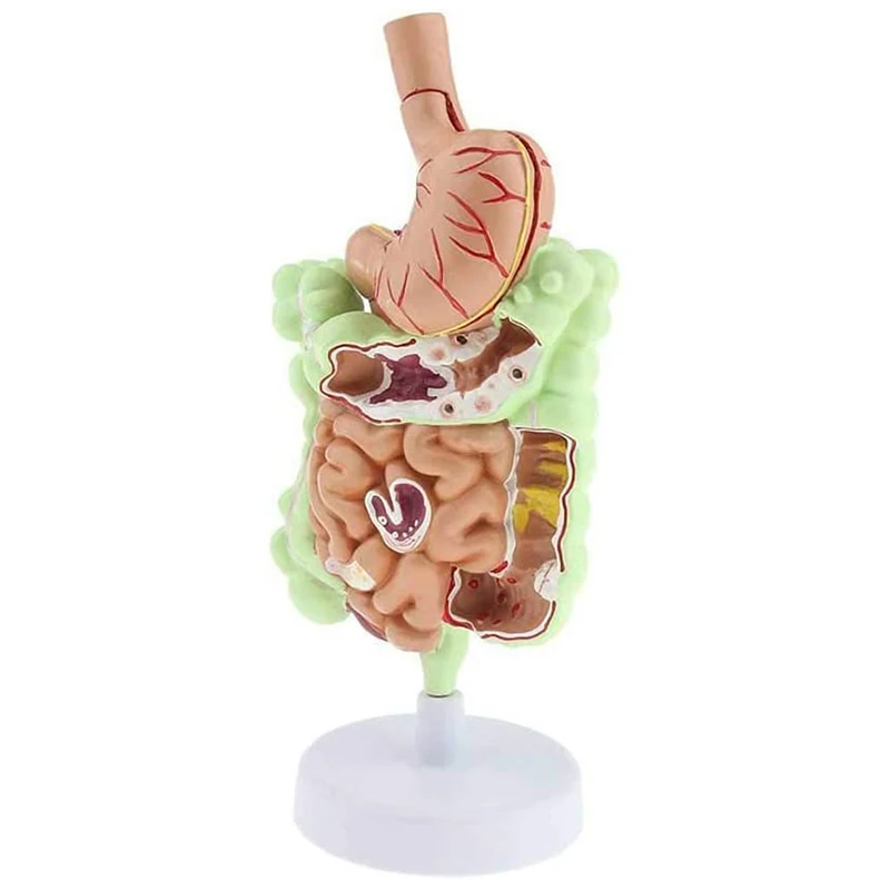 

Human Digestive System Anatomy Model Medical Teaching Resources Drop Shipping