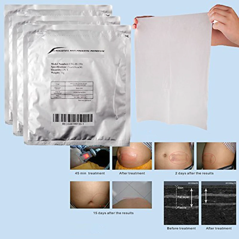 50pcs Antifreeze Membranes High Quality Anti Freezing Membranes Beauty Equipment Accessories For Fat Freeze Treatment Cryo Pad