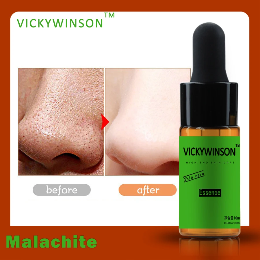 

Malachite essence 10ml Face Serum natural Malachite toner serum extrace essence Detox Whitening Moisturizing face skin care