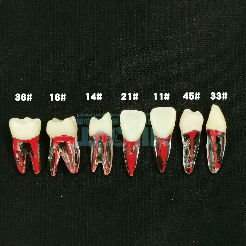 2PC Dental Endodontic Tooth Model Root Canal Teeth Teaching Modeling  Training Tooth For Student Endo Physical Therapy Practice