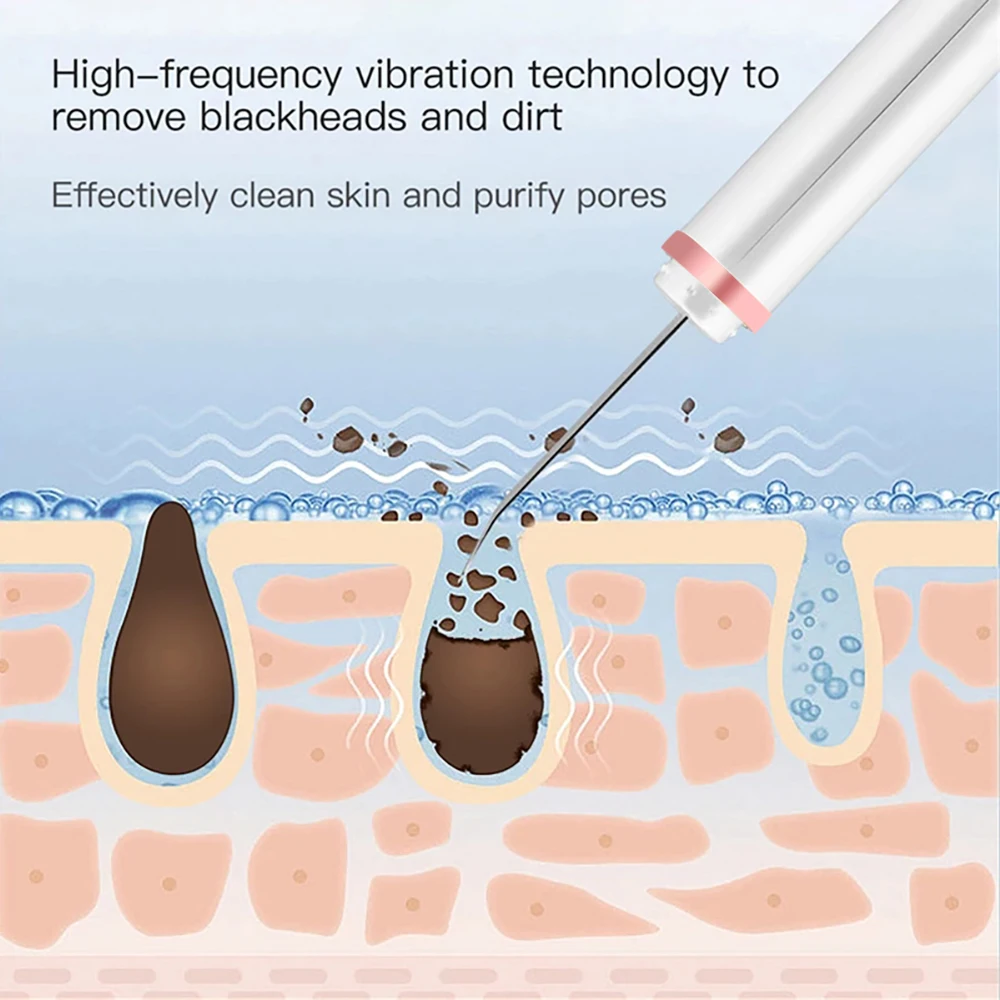 Ultrasuoni Scrubber detergente per il viso ione Acne rimozione di punti neri Peeling pala detergente massaggiatore facciale macchina per il lifting del viso