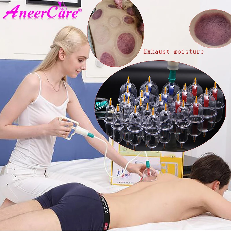 

12-24set Health Care Chinese Medical Vacuum Cupping Cups Suction Cans Body Massage Jar Set Suction Therapy Anti Cellulite