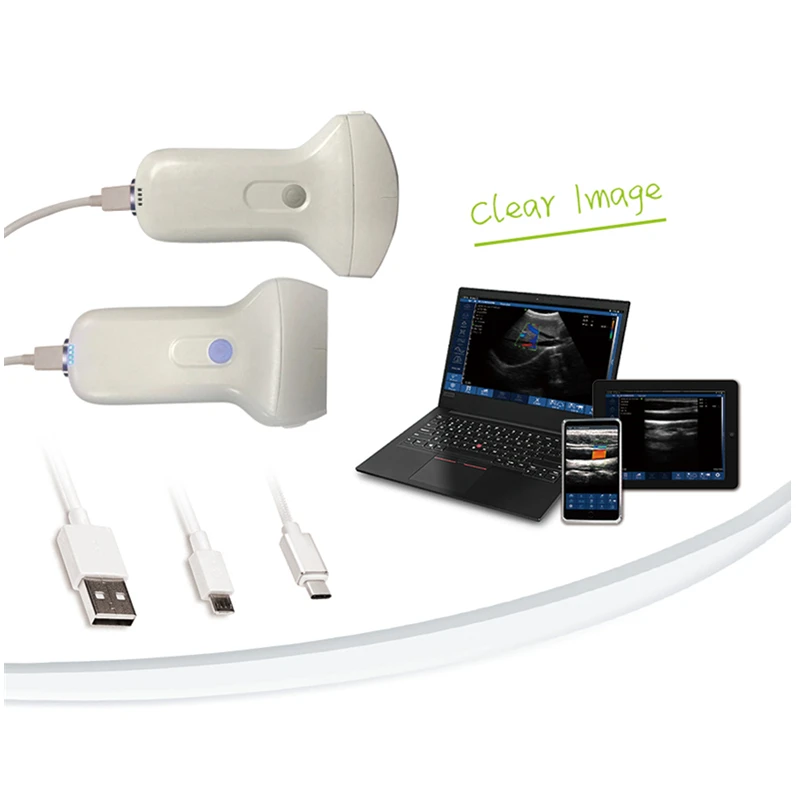 

Color Doppler USB/Wifi Double Mode Wireless Ultrasound Convex Linear Probe Andriod, IOS, Windows System