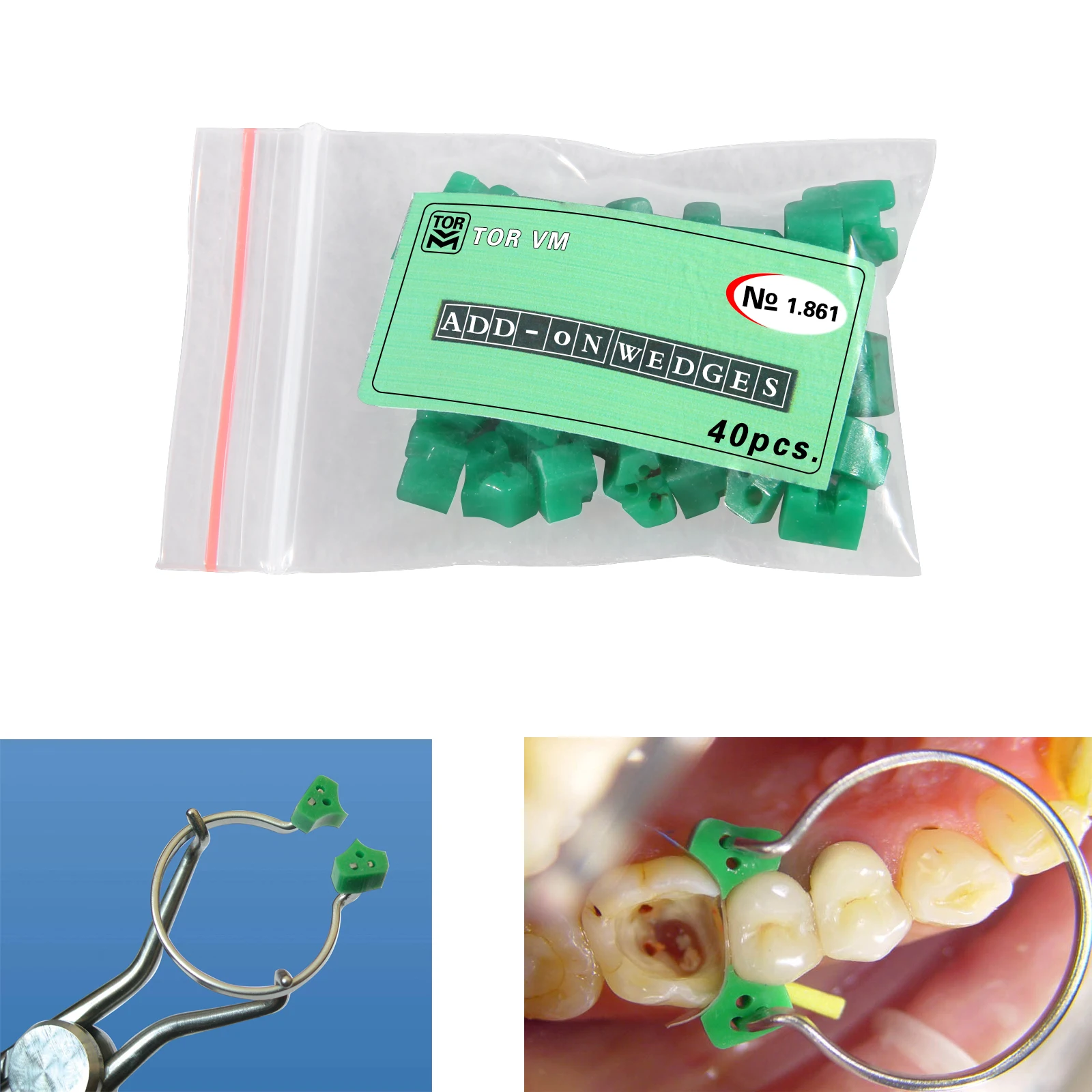 

1/5/10pack New Dental Add On Wedges Orthodontic Special Silicone Rubber 150 °C Autoclavable High Quality