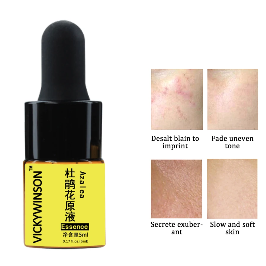 Đỗ Quyên Tinh Chất 5Ml Serum Cho Da Mặt CreamAnti Nhăn Lão Hóa Hyaluronic Tinh Chất Trắng Da Mặt Serum