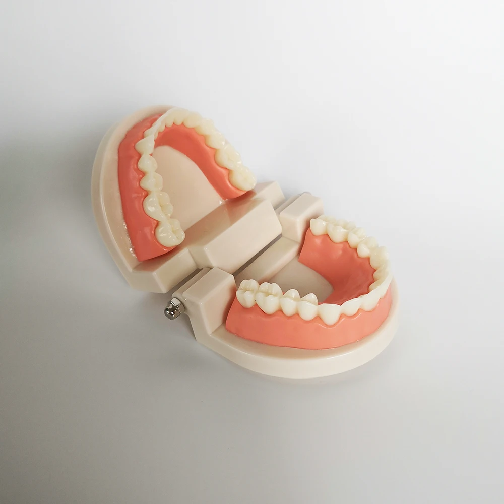 Neues Dentalmodell für Zahnimplantate, Restaurationsbrücken, Lehrmaterial für Medizinische Wissenschaft, Krankheiten, Zahnärzte und Zahnmedizinprodukte – Detail 8