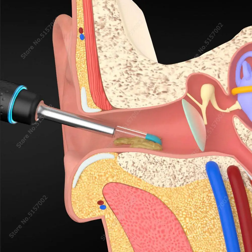 Bebird M9 Pro Smart Visual Ear-Stick Endoscope 300W High Precision In-Ear Endoscope with 300mAh Magnetically Charged Base