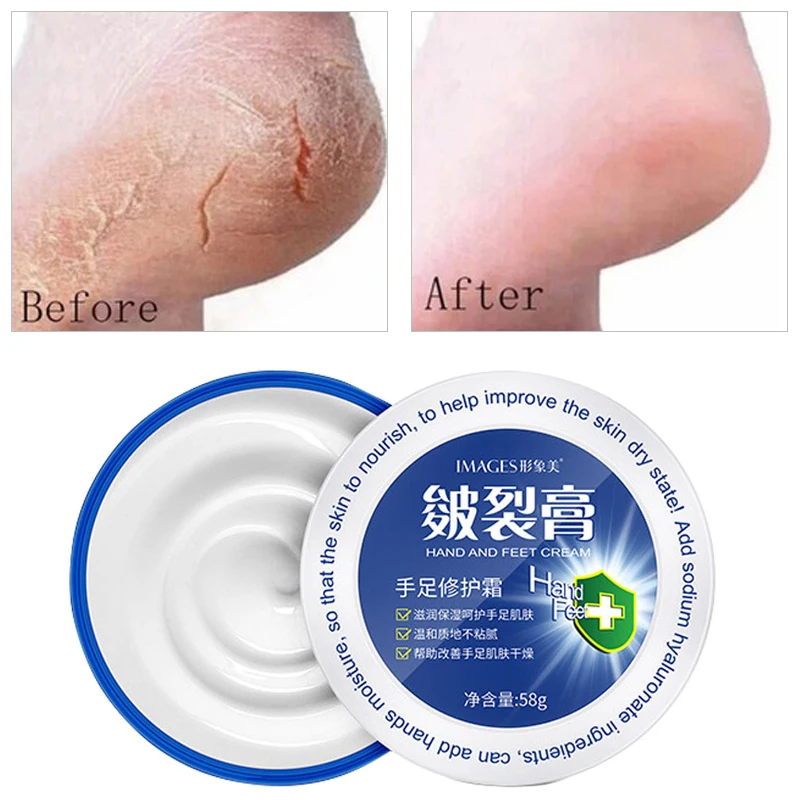 

Foot Cream Repair Dry Cracked Hands And Feet Smooth Fine Lines Moisturizing Hydrating Remove Callus Dead Skin Hand And Foot Care