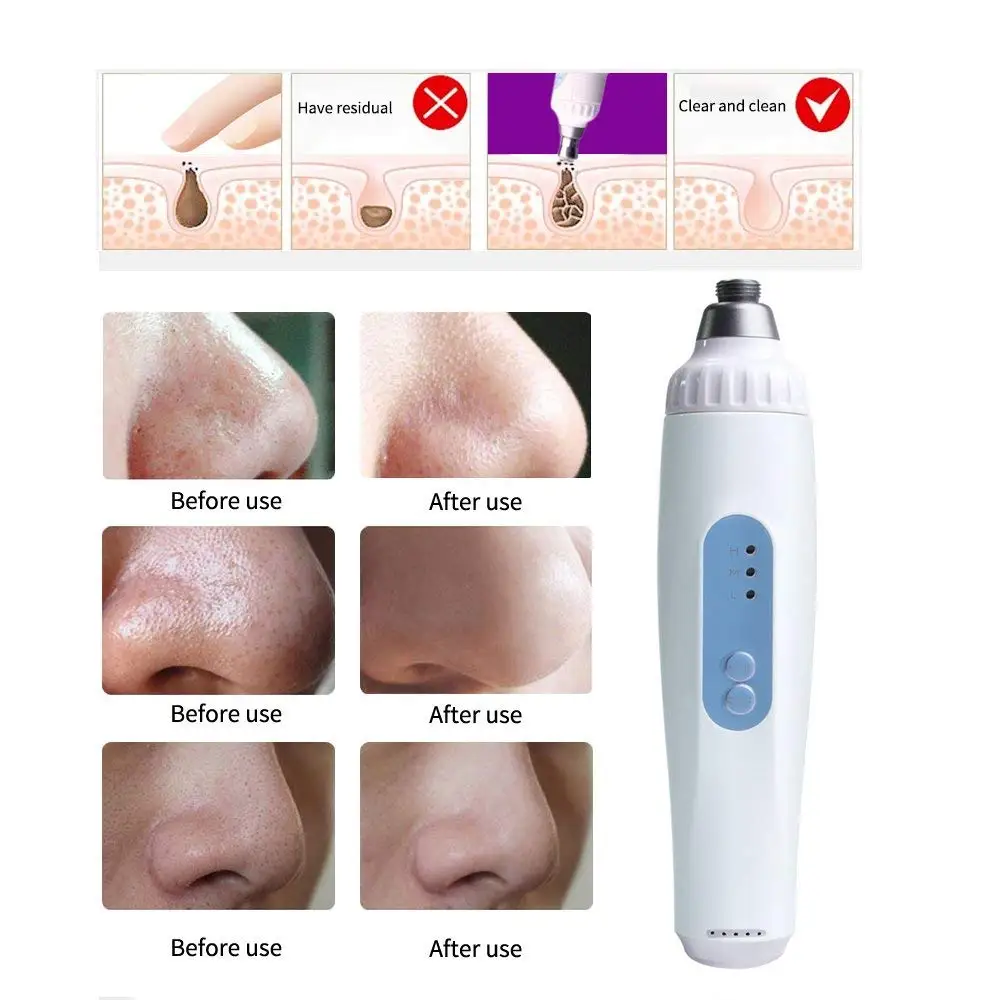 Portable Diamond Dermabrasion Microdermabrasion Skin Rejuvenation Facial Vacuum Skin Care Massager Face Exfoliator Device