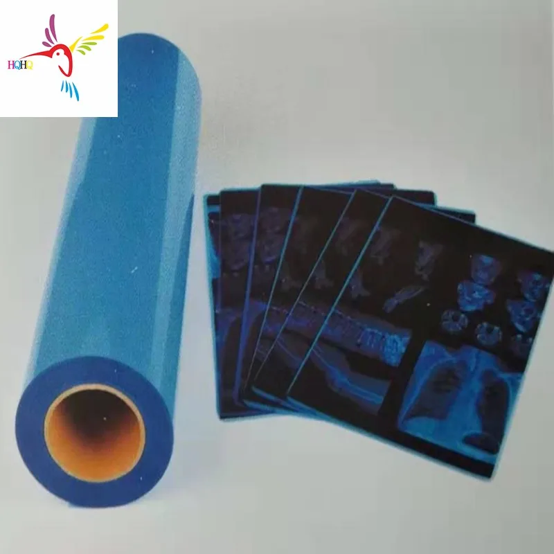 175 Microns Blue Inkjet Medical Film for EPSON CANON HP and All Kinds Printer Used As  X-Ray CT CR DR MR and PET-CT