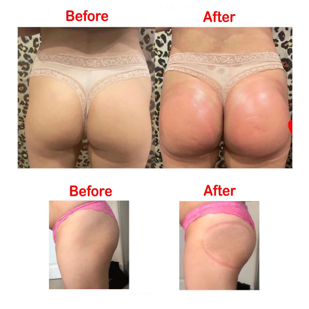 2PCS Dia 21 cm 180ml Buttock Sucker Vacuum Stimulator Cups Breast Enlargement Pump Cupping Accessories