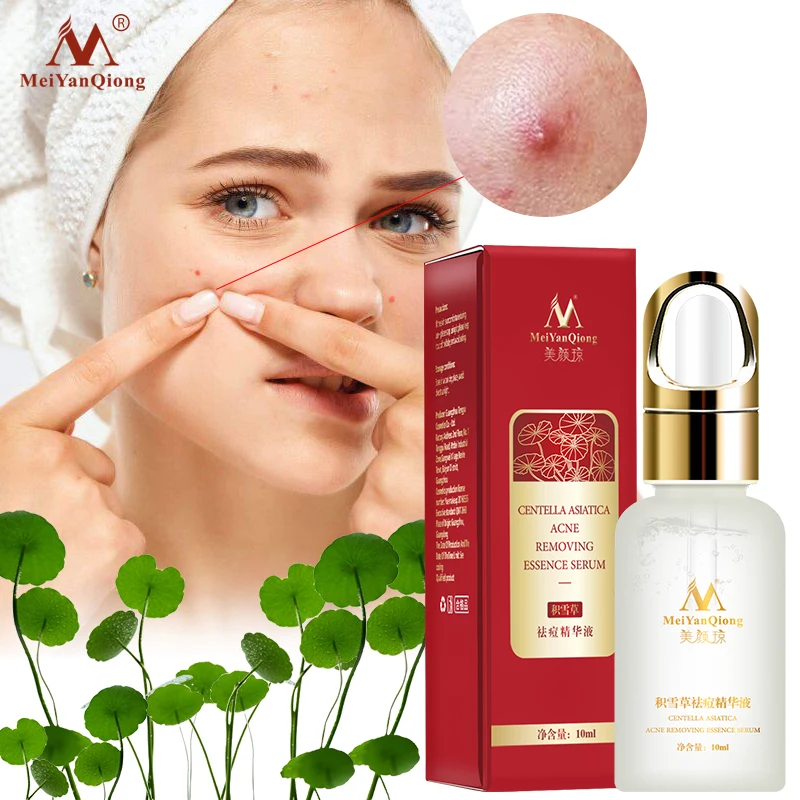 

Centella Asiatica Acne Removing Essence face Serum liquid Moisturizing Anti Wrinkle Shrink Pore Control Oil Whiten Skin 10ml