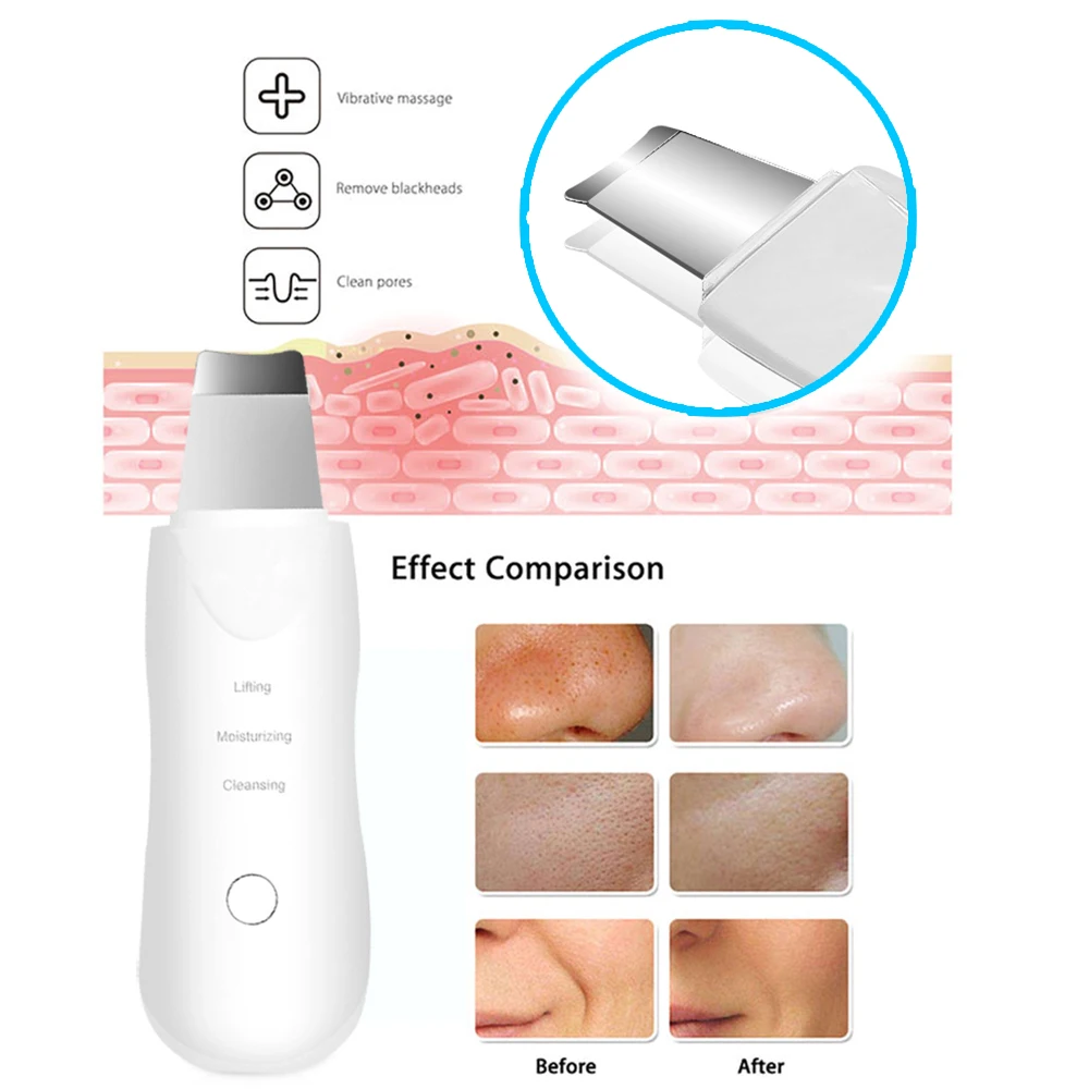 Facial Massager Ultrasonic Skin Scrubber Scrubber Deep Vibrate Facial Cleaner Shovel Face Scrubber Peeling Black Head Remover