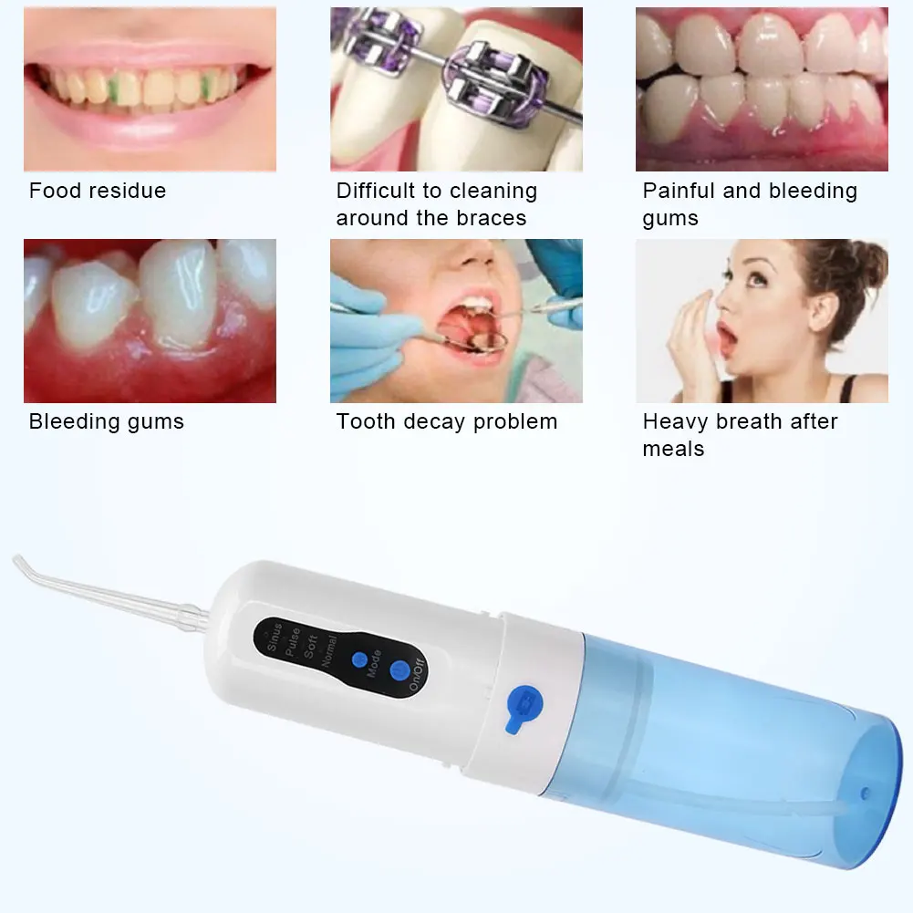 4Mode Listrik Oral Irigator Flosser Air USB Portabel Pengisian Alat Pembersih Gigi Rumah Hapus 99% Plak Mencegah Kerusakan Gigi