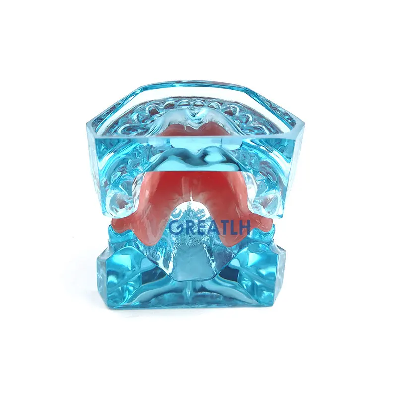 Dental Onderwijs Model Removable Model Orthodontische Model Met Retainer