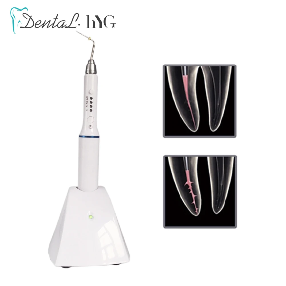 Dental Wireless Cordless Obturation Pen Endo System Hot Melt Gutta Percha Filling System with 4 Endo Heated Tips