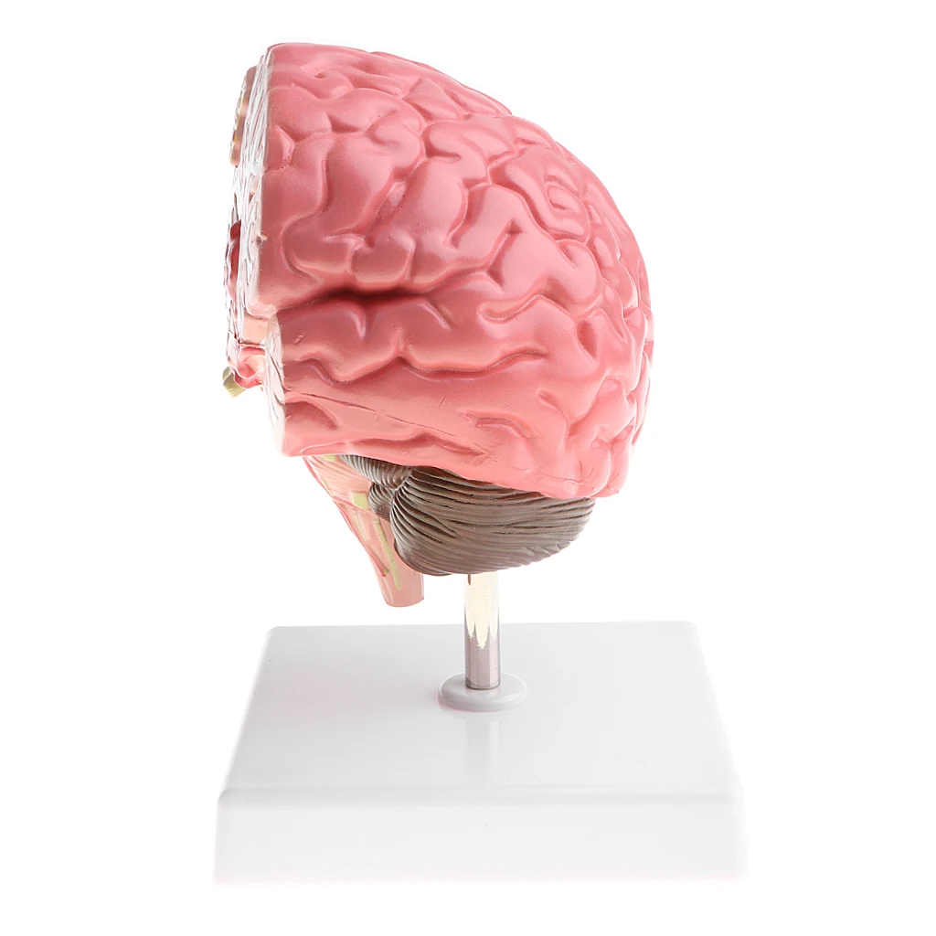 Anatomical Human\'s Brain Disease Pathological Model Medical Teaching Tool Lab Display Model School Educational Brain Model