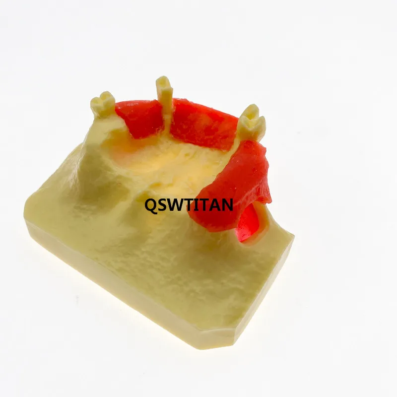 Dental Sinus Lift Practice Teeth Model Typodont Study Model Demonstration teaching tooth model