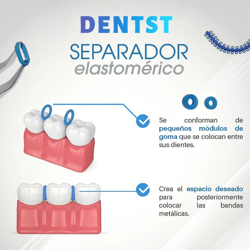 Dentst Tandheelkundige Orthodontische Separator Rubber Separator 700 Stuks Of 10 Stuks Scheidende Veer Voor Ortodoncia Nep Beugels Beugels